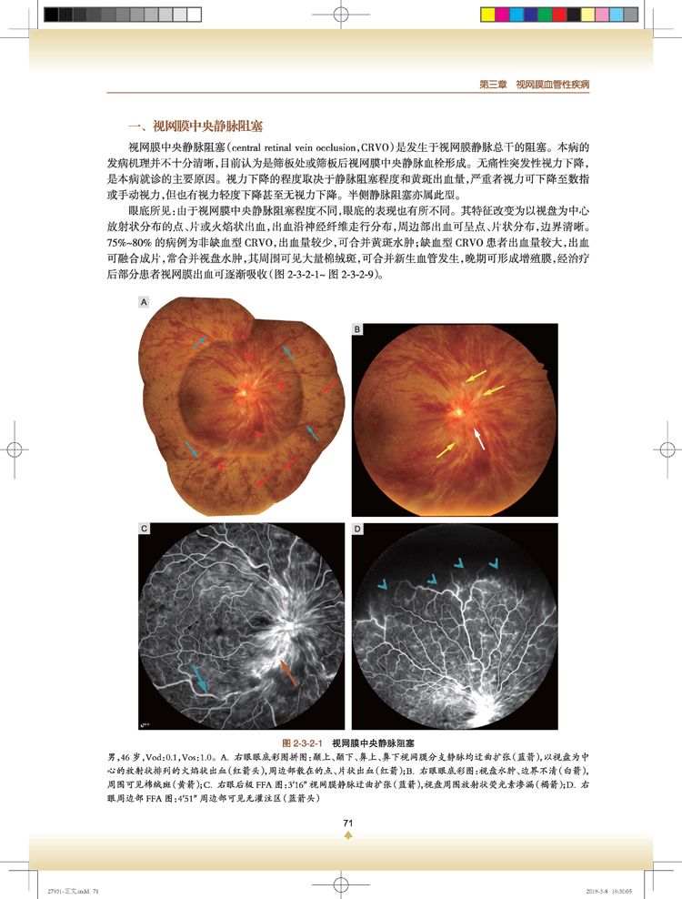 眼底照相技巧与彩图解读